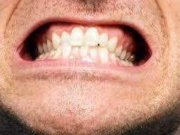 teeth.jpg